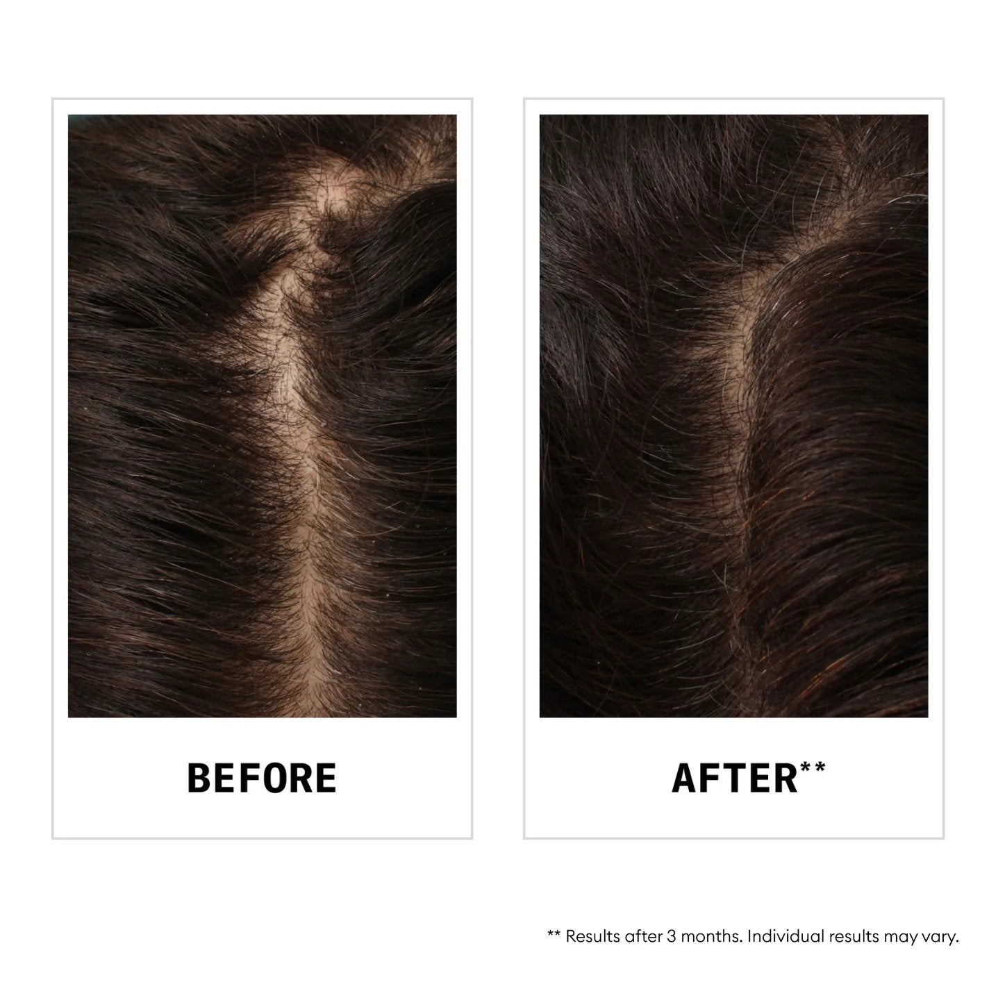 NIOXIN Anti-Hairloss Sjampó