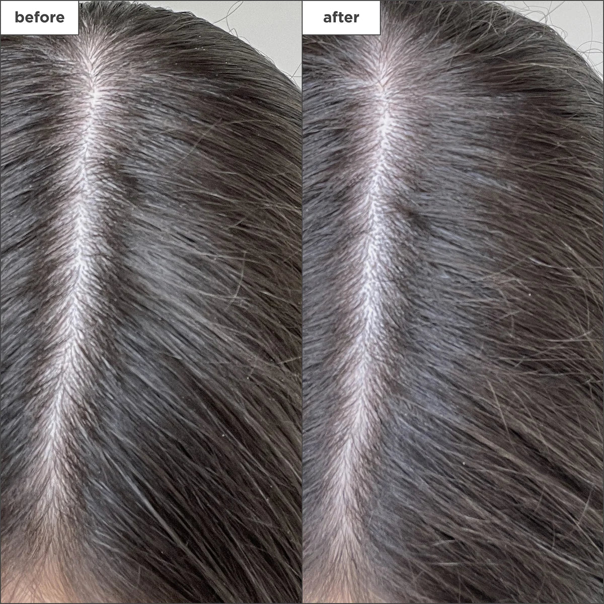 Briogeo Scalp Revival Charcoal + Biotin Dry Sjampó