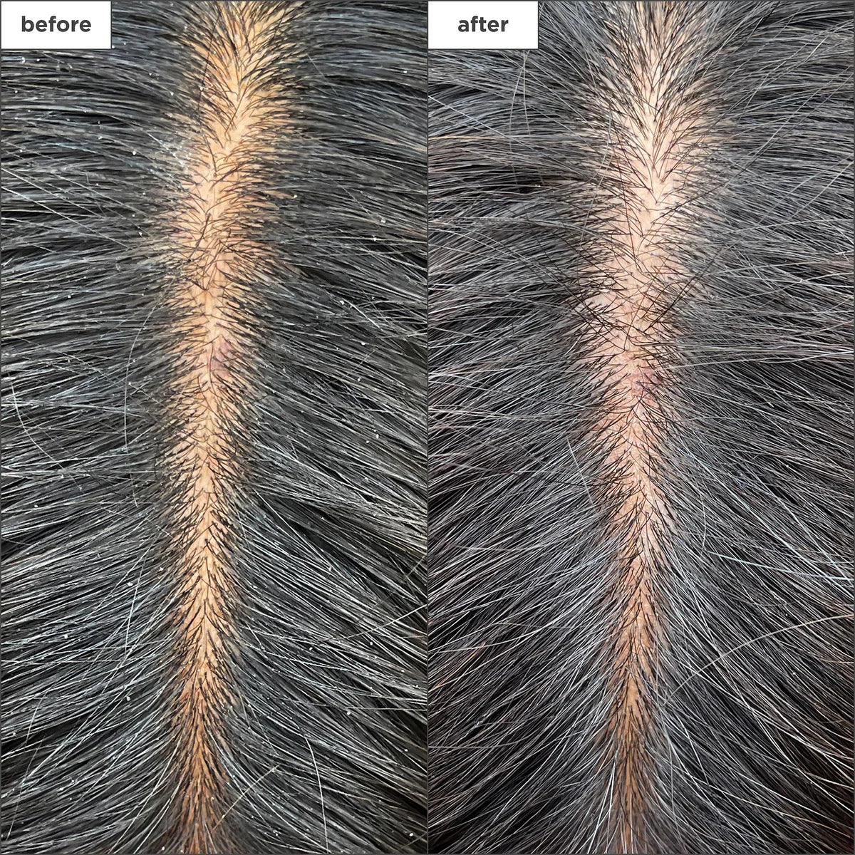 Briogeo Scalp Revival MegaStrength+ Dandruff Sjampó